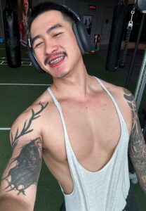 THIRACHAI-BUTSRI-ดัดฟัน